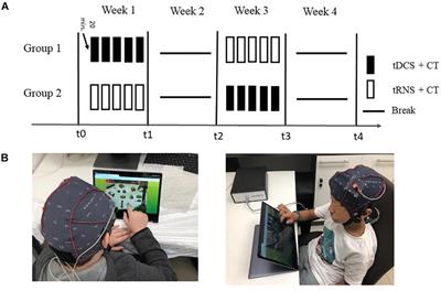 Examining the Effect of Transcranial Electrical Stimulation and Cognitive Training on Processing Speed in Pediatric Attention Deficit Hyperactivity Disorder: A Pilot Study
